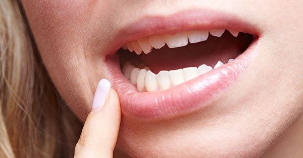 Sensibilitá dentale