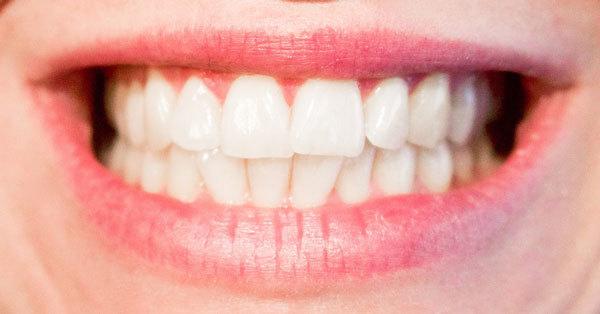 Come si cura un dente cariato?